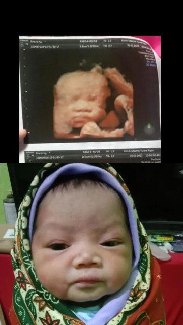 Tips agar asi banyak