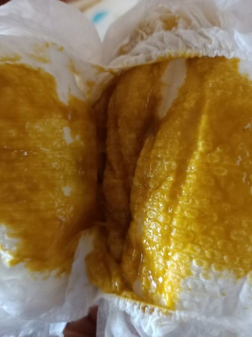 bab bayi 5 bulan cair