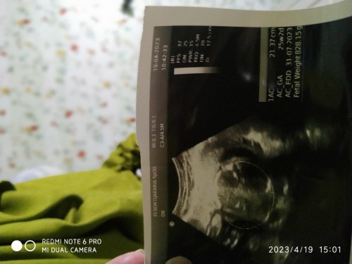 kira kira jènis kelamin bayi apa ya ..