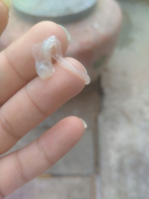 อยากทราบว่าแบบนี้คืออะไรคะ ท้องแรกค่ะ