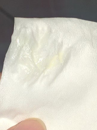 Keputihan di week 38