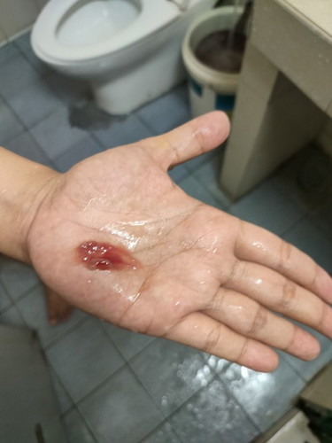 semalam balik dr pac doc check bukaan bru 1 nk masuk 2. pastu siang td keluar darah cmnie bila pee.