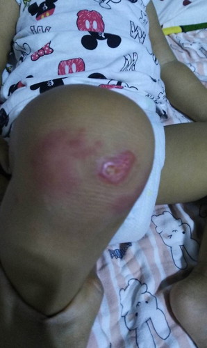 allergy? viral infection? rash?