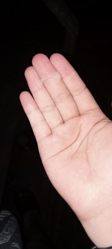 ตอนนี้ 35+2 มีมูกใสแบบนี้หมายถึงอะไรคะ