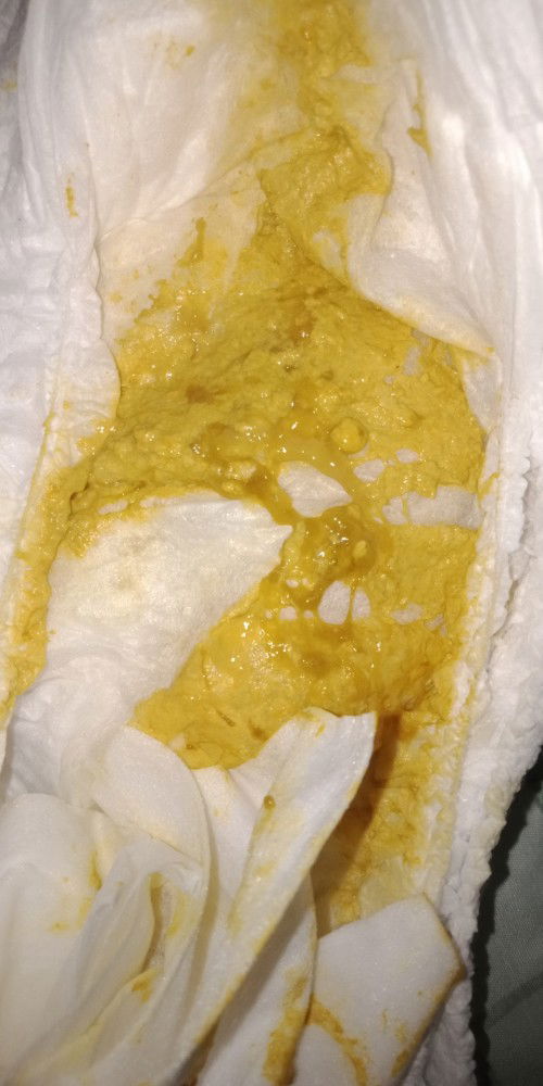 ขอสอบถามหน่อยน่ะค่ะ