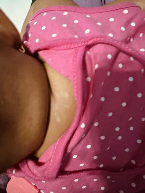 Bercak putih di bawah leher belakang