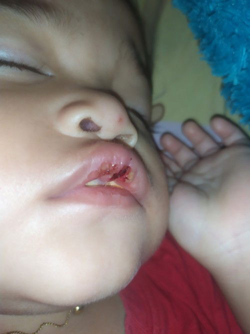 Sariawan Atau Apa ya??