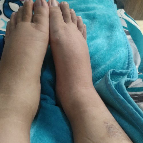 HPL 24 28 apr . kira2 lahiran kapan ya . udh serba gaenak bgt . kaki bengkak