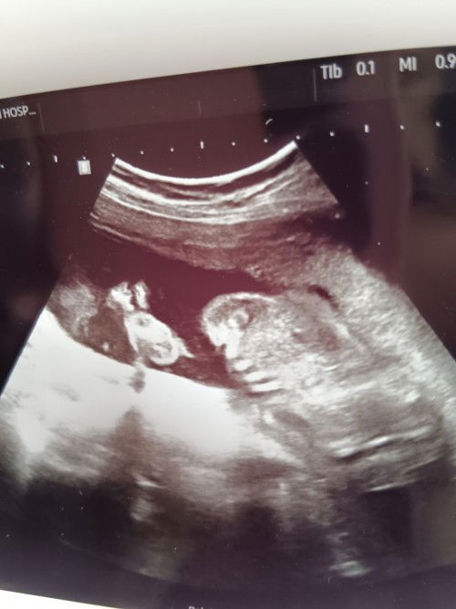 ดูไม่ออกว่าส่วนไหนของลูก