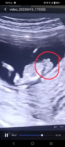 แม่ๆช่วยดูหน่อยญ/ชคะ