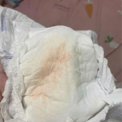 Hello mga mi, Dehydrate kaya si baby? May nabasa kasi ako na pag ganto yun daw kadalasan, sobrang