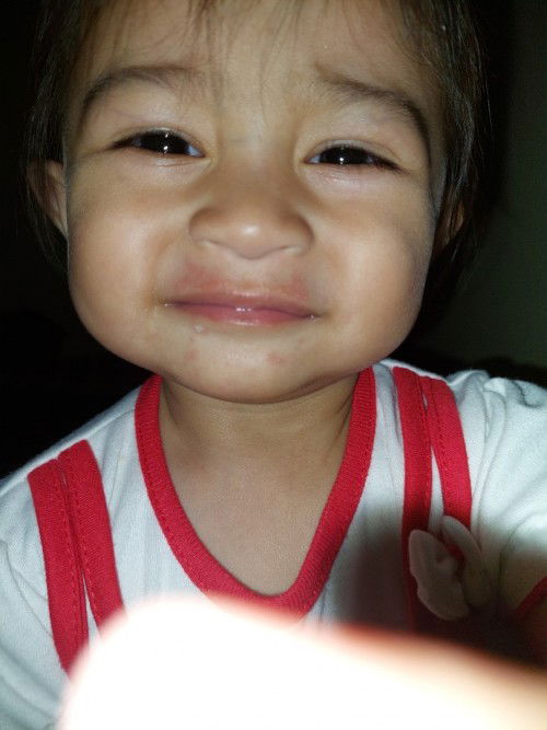 Bintik merah area bibir