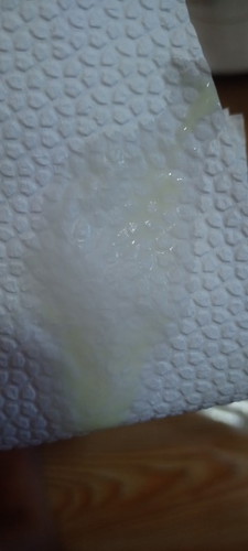 UNUSUAL DISCHARGE