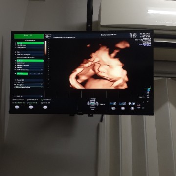 35week น้องน้ำหนักเท่าไหร่แล้ว