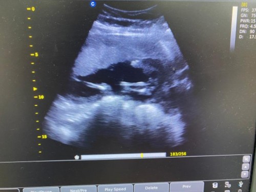 Nak tahu gender baby