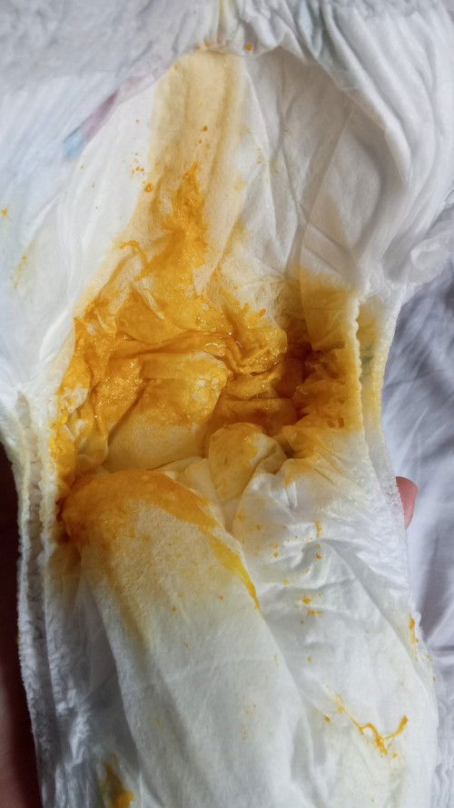 Bab kuning berlendir, bayi 3 bulan