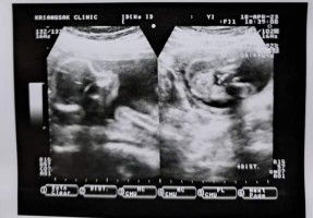 แม่ไค่ะสอบถามหน่อยค่ะ