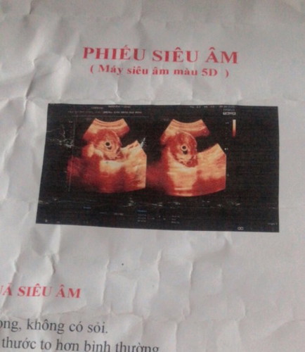 Vợ mìh bầu được 6 tuần nhưg ngày nào cũg đau bụg dưới, các mom cho mìh hỏi thai nhi có vấn đề gì k ạ