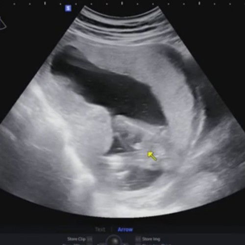 แม่ๆช่วยดูหน่อยคะ ชายหรือหญิง 16w