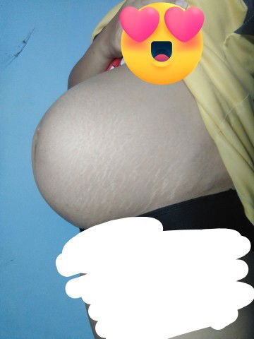 แบบนี้ท้องใหญ่เกินไปมั้ยค่ะ