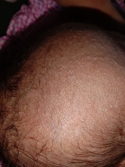 Bintik di kening bayi