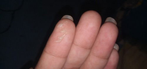 ถามแม่ๆค่ะ นี้คือตกขาวหรือมูก ค่ะก่อนหน้านี้มีสีน้ำตาลปนมาหน่อยหนึ่งค่ะ แล้วมาวันนี้นอนๆยุรุ้สึกว่า