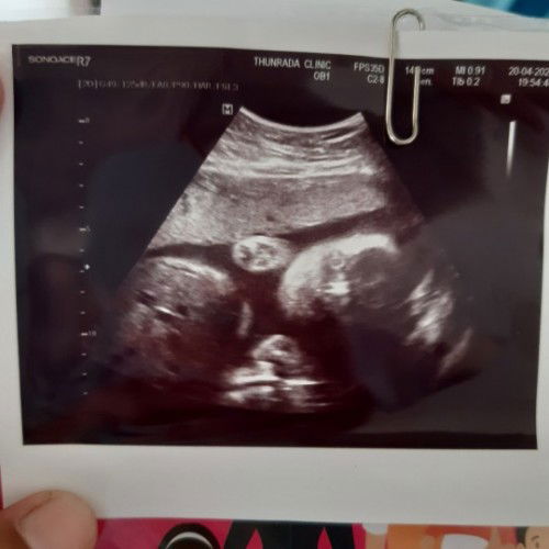 ใช่หน้าน้องมั้ยคะ