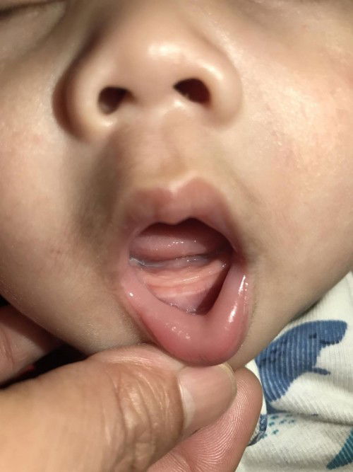 ใช่ฟันขึ้นรึป่าวคะ