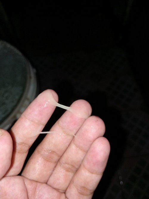 Kehamilan 39weeks lebih 3hari