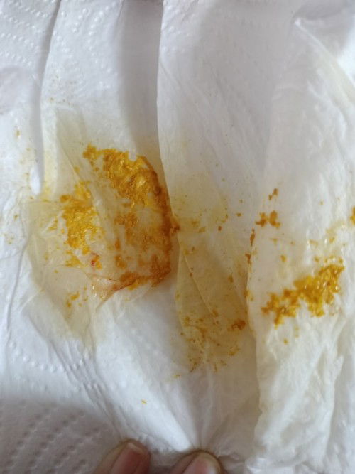 อึลูกมีมูกเลือดปนอันตรายไหมคะ