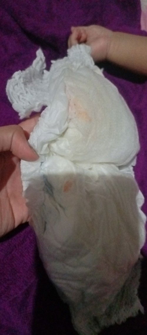 Bun mau nanya pipis bayi usia 6 bulan