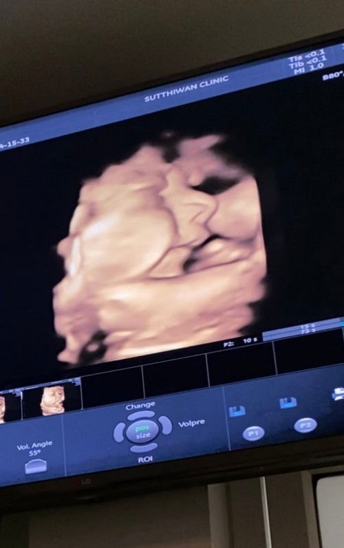 สอบถามแม่ๆหน่อยค่ะ 🤰✌️