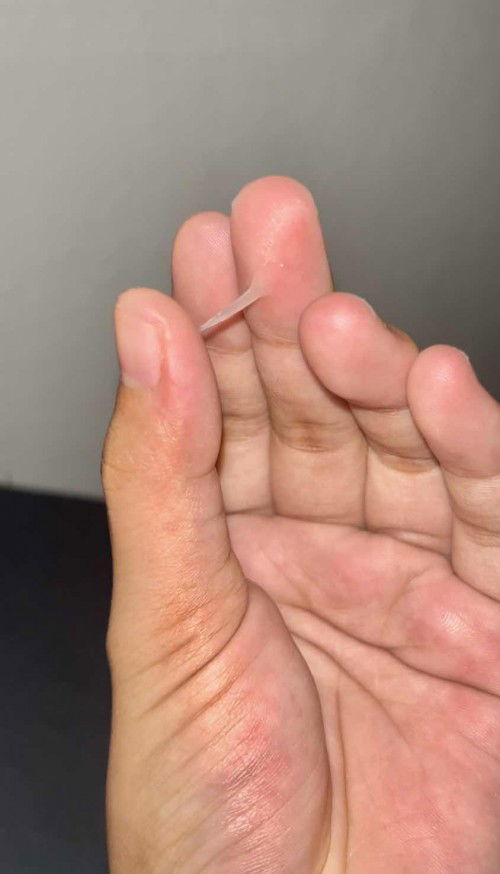 ท้อง37+4 มีมูกใสติดออกมา