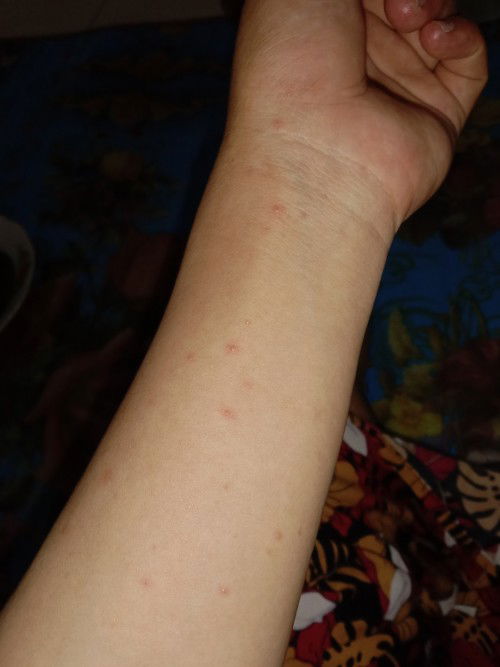 Kulit bintik-bintik merah kecil