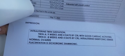 37 WEEKS TAS D PA READY 😅😂 YUNG MGA GAMIT WALA DING FUNDS