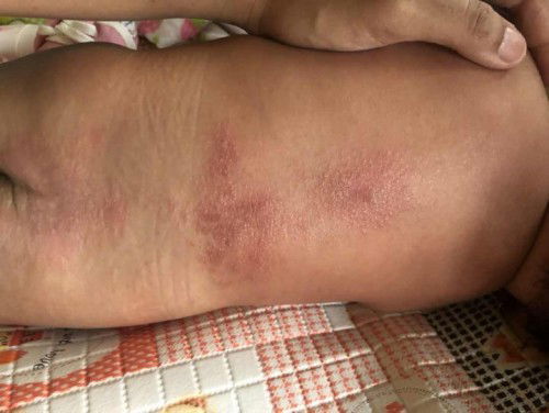 Rekemondasi dong bunda2?