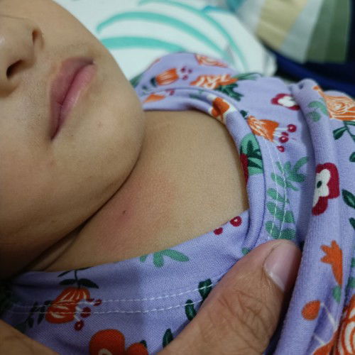 Sino po kaya ang may baby na since birth my dalawang tuldok sa dibdib ni baby? Answer please 🙏🙏