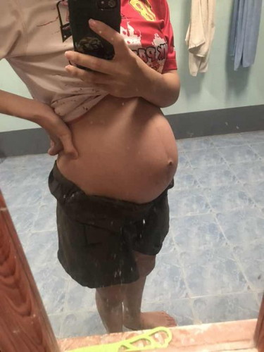 28w+ ท้องแรก