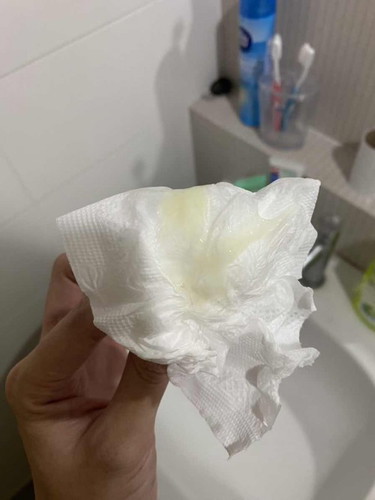ขอคำปรึกษาทีค่ะแม่ๆ 36+2 มีแบบนี้มูกหรือตกขาวค่ะ