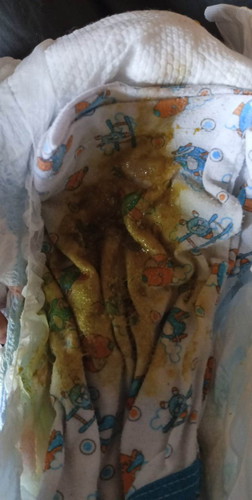 ngpoop ng green dhil ba my sipon at ubo si baby? or dhil ngiipin n rin sya?ntural lng po ba ito?