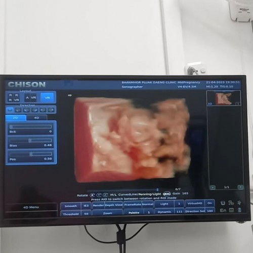 ลูกสาวสมใจแม่กับป๊าเลยค้า👧🏻💞 #สาวน้อยทีมกันยา