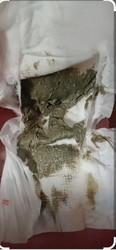 Green poop
