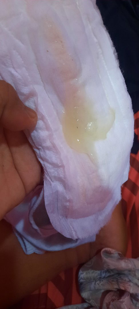 Mau Tanya Serius 🥺 Hamil anak Pertama