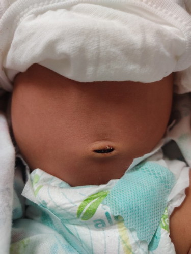 Normal po ba may kunting dugo sa pusod ni baby?