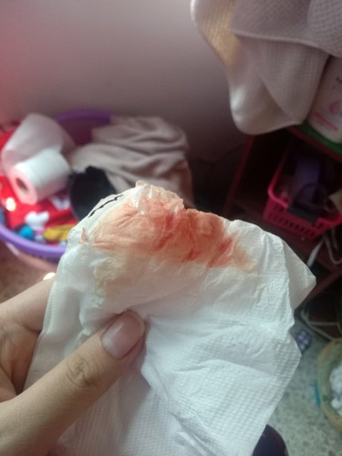 แบบนี้จะได้คลอดรึยังคะ