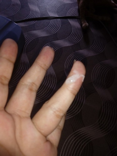 เมือหรือตกขาว