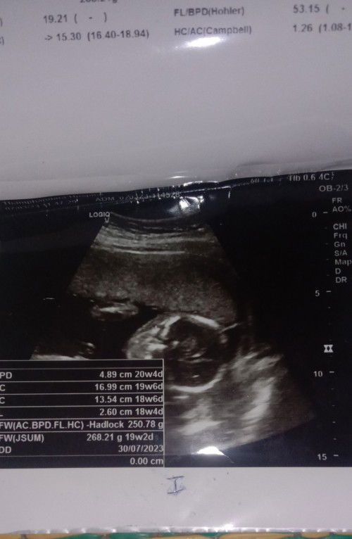 สอบถามเรื่องเพศลูกค่ะ