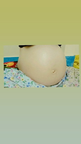 แม่ๆมีอาการคันท้องตอนกี่วีคคะ
