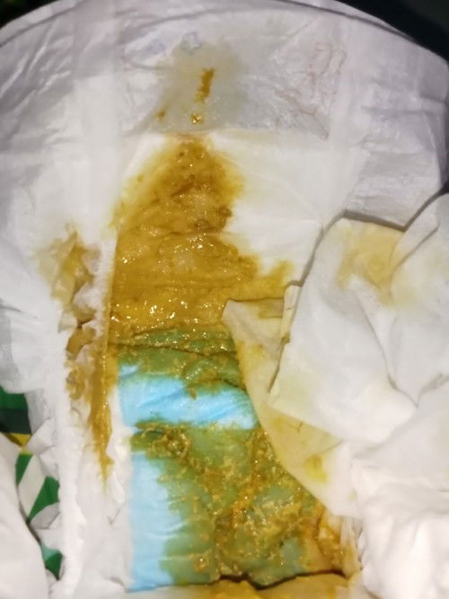 Normal lang po ba ang poop ni baby kapag ganito prang basa po kasi breastfeed po siya