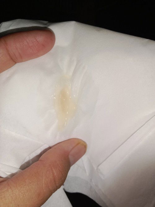 Kehamilan 39 W, keluar lendir jell